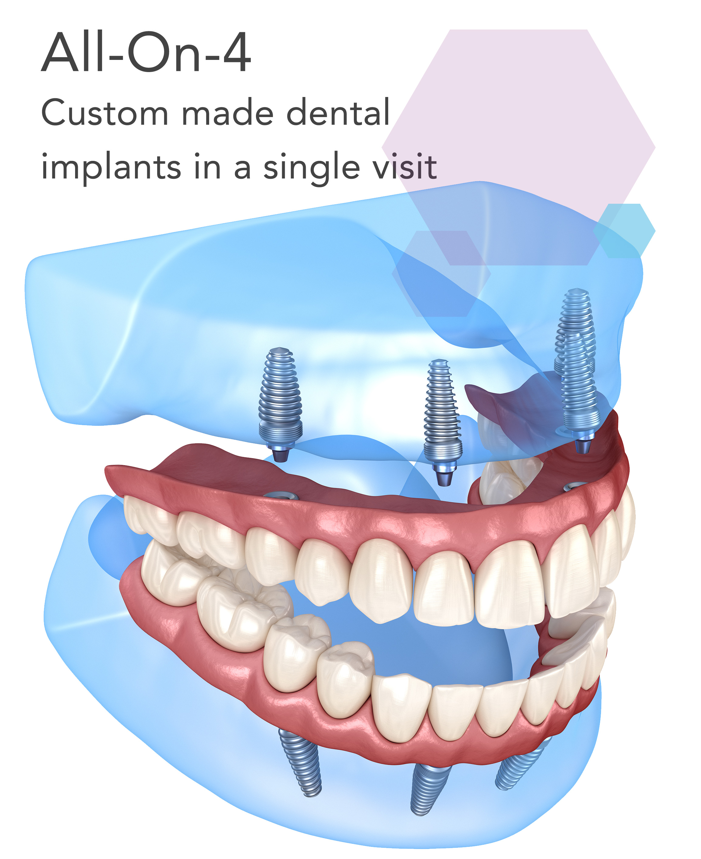 family dental practice ballymoney, ballycastle co. antrim