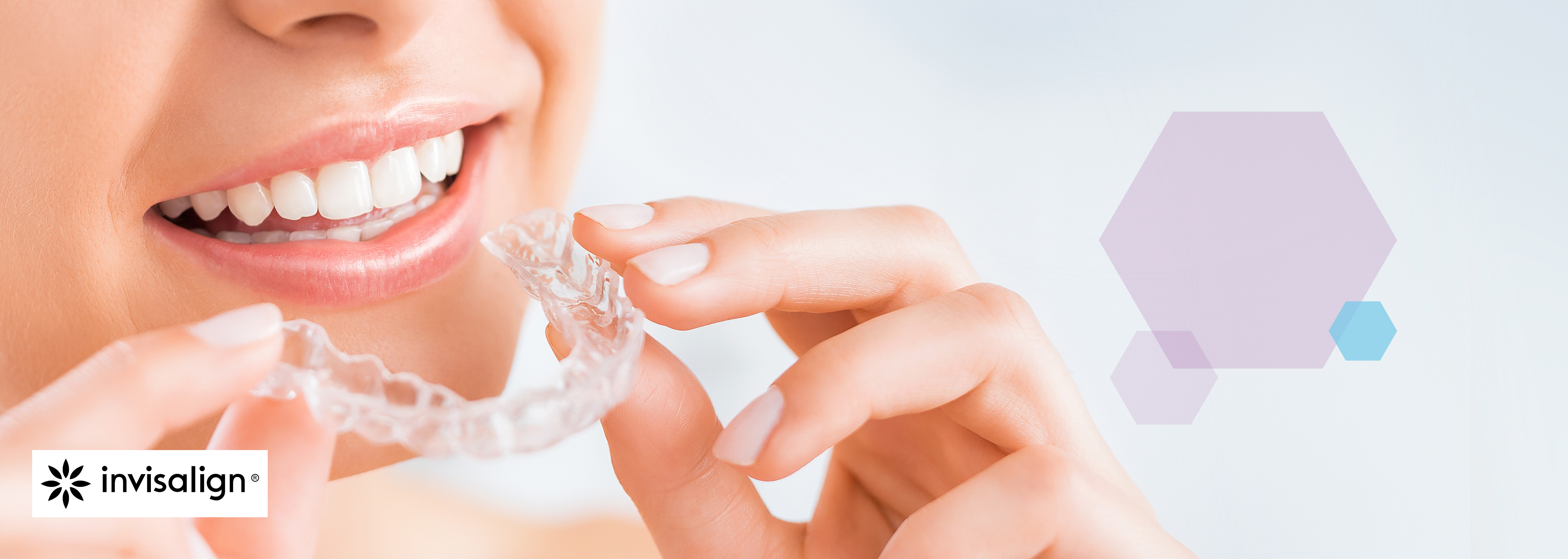 invisalign ballymoney, coleraine, ballymena, ballycastle